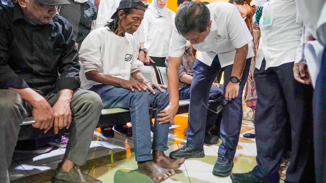 Menkes: Kusta Bukan Kutukan, Jangan Takut Lapor
