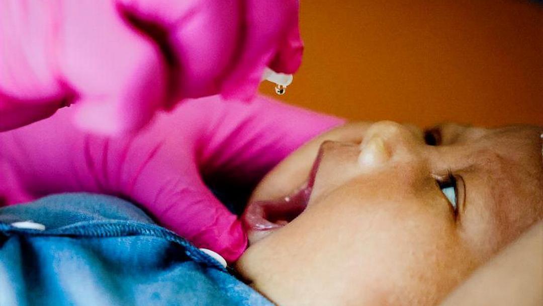 Indonesia Umumkan Kejadian Luar Biasa (KLB) Polio Berakhir