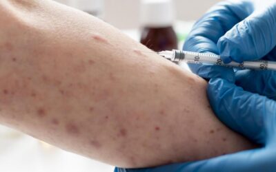 Waspada Campak Jelang Libur Lebaran, Kemenkes Percepat Imunisasi Anak di Wilayah Risiko